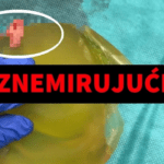UZNEMIRUJUĆ SADRŽAJ! Hrvatski kirurg pokazao što je našao u prsištu žene koju je operirao drugi kirurg. Živi užas, fotografije uznemiruju